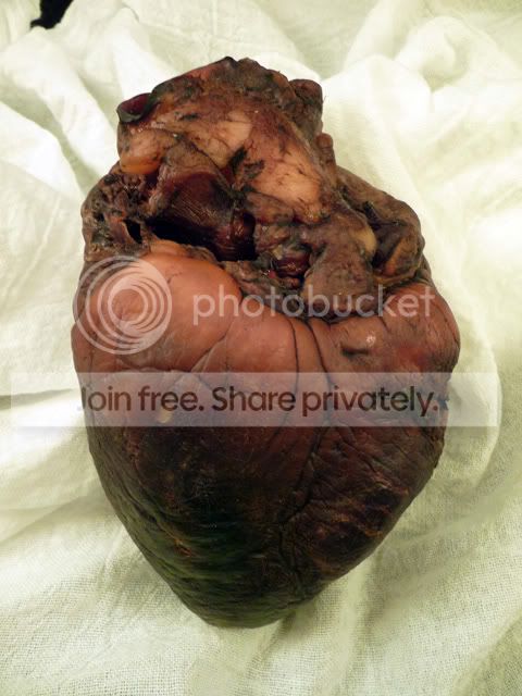 mummifiedvampireheartcloseupside.jpg